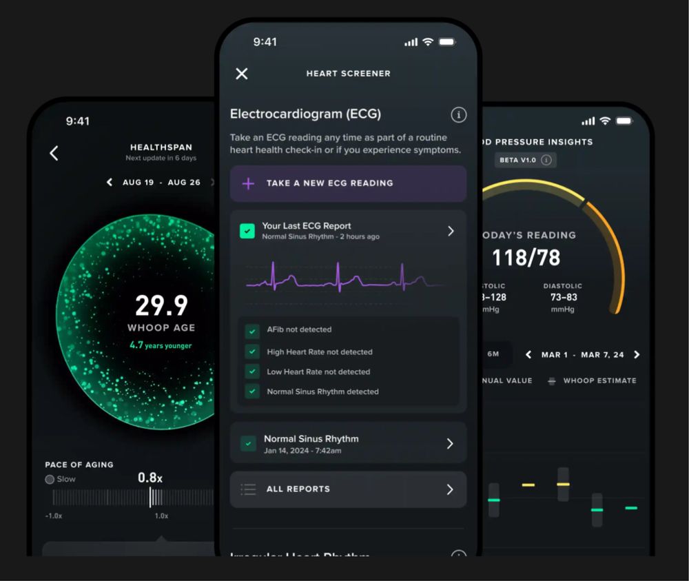 WHOOP MG 5.0 Life с годовой подпиской