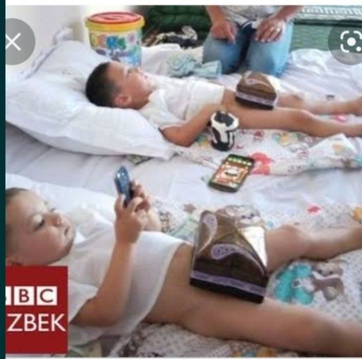 Лазерное обрезание детям и взрослым