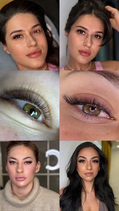 Extensii de gene, Sector 2, București