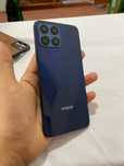 Honor x8 holati yahshi