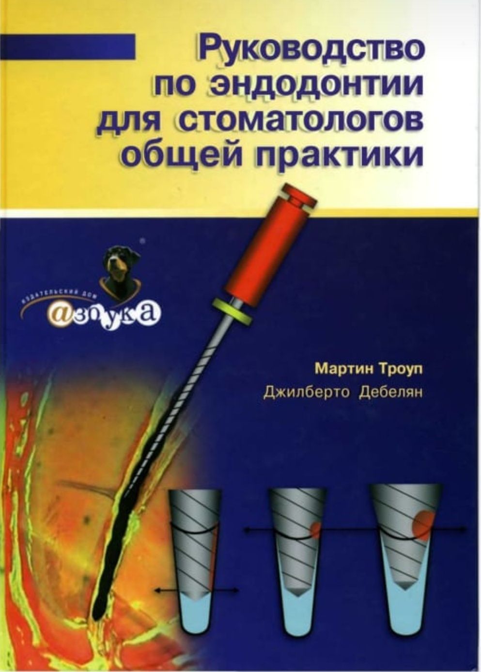 Эндодонтия, книги для стоматологов. Артак Антанян, Мартин Троуп