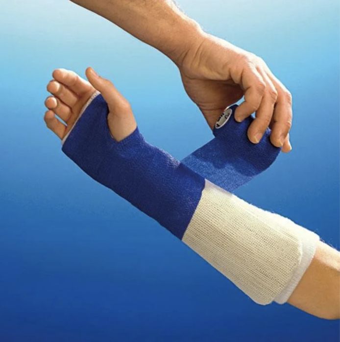 Наложение Французского Пластикового Гипса СКОТЧКАСТ. Перевязки