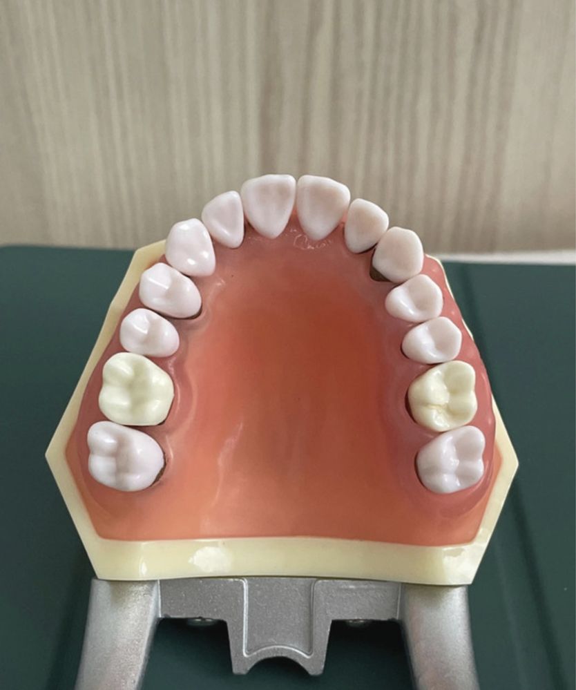 Model boală parodontală cu dinţi detaşabili cu şurub - 4023