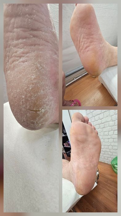 Pedichiură clasică Oradea