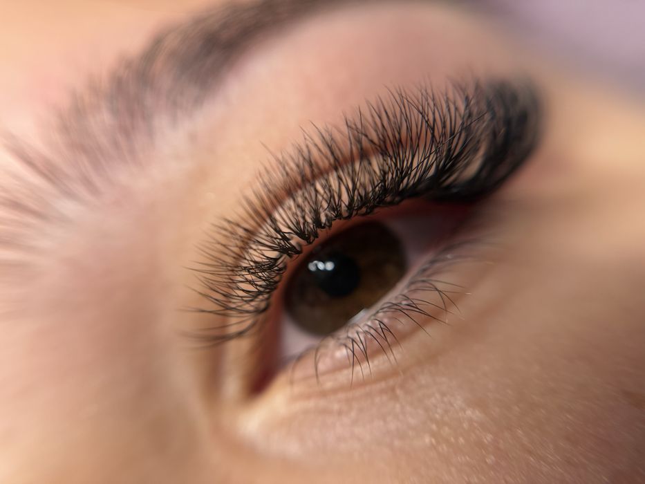 Промоция! Миглопластика и ламиниране