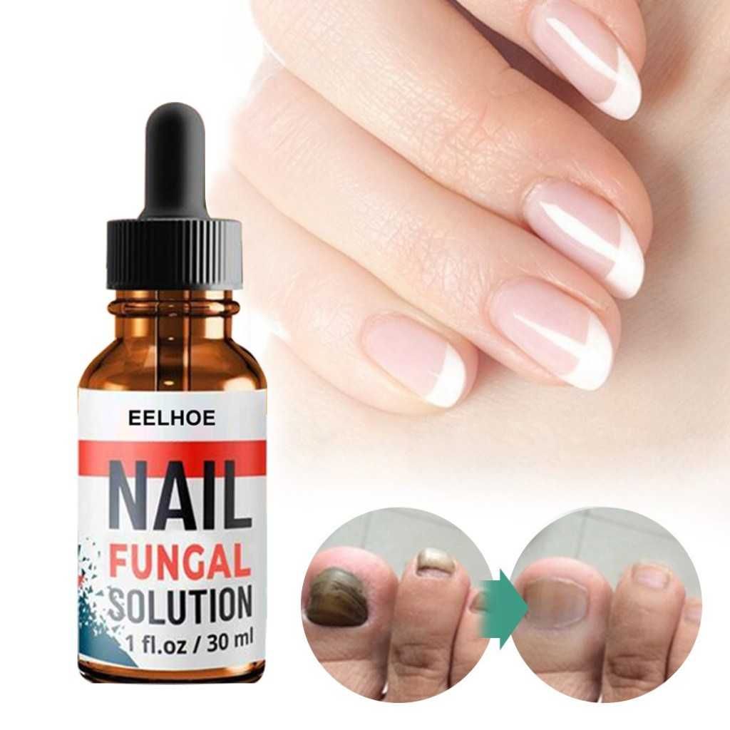 Продукт за лечение на гъбички по ноктите Eelhoe 30 ml