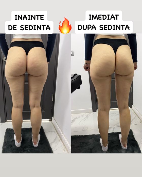 Masaj anticelulitic si remodelare corporala!
