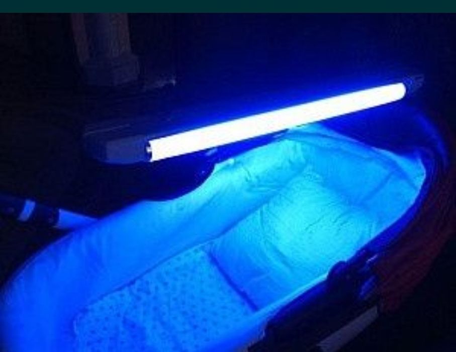 Фотолампа от желтушки