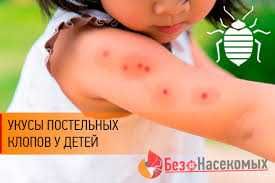 Дезинфекция Уничтожение тараканов клопов муравьев ос блох мышей крыс