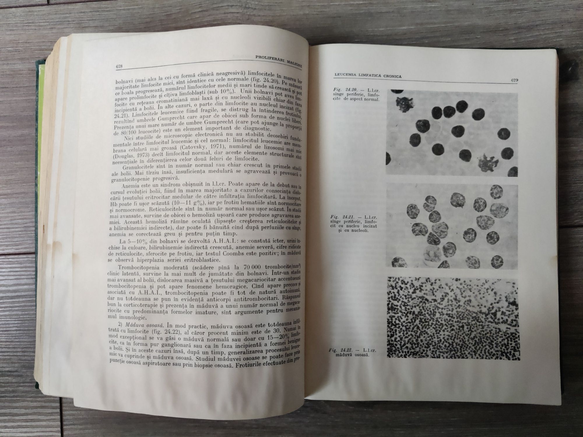 Tratat de Hematologie Clinica Berceanu