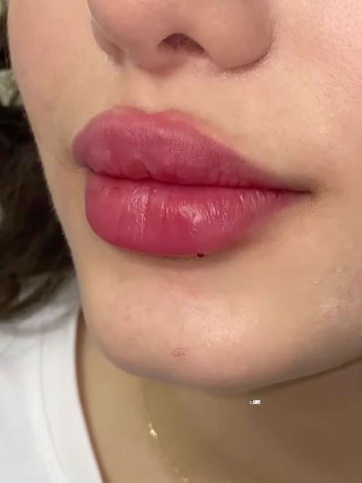 Оффлайн курс все включено по косметологии по доступной цене Астана