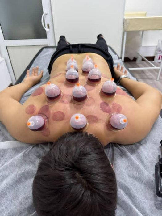 Hijoma xijoma muolajasi hijoma xizmati