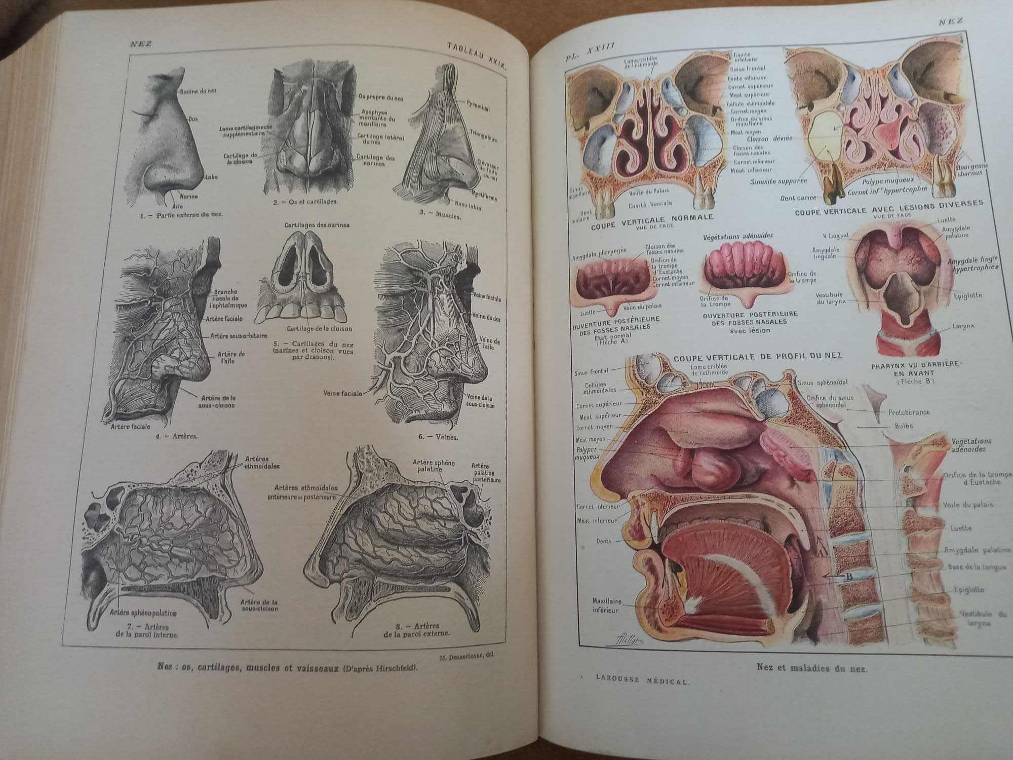 Enciclopedie Medicala Ilustrata Larousse publicata in 1929