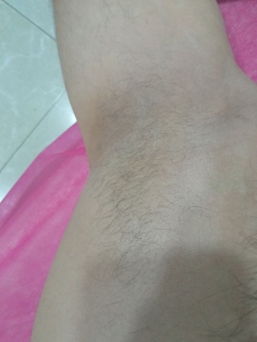 Депиляция мужская и женская