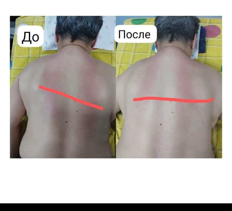 Емдік сауықтыру массажы