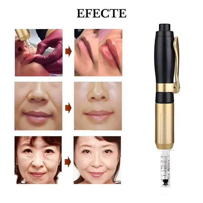 Hyaluron Pen nou + 10 cartuse (0.3 & 0.5 ml) | buze, riduri