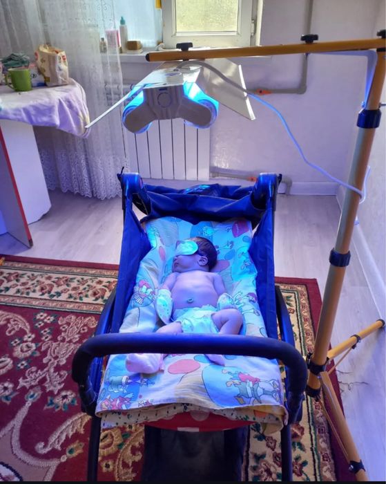 Фотолампалар, сарғыштықтың лампасы ,лампа кювез, билитест