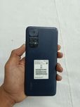 Redmi note 11 sotiladi