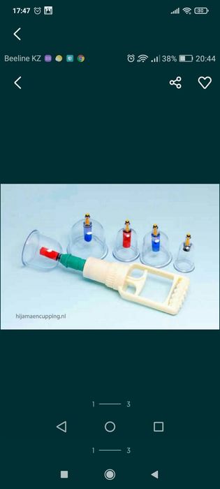 Хиджама кровопускание