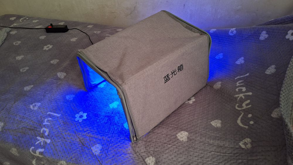 УФ Лампа от желтушки