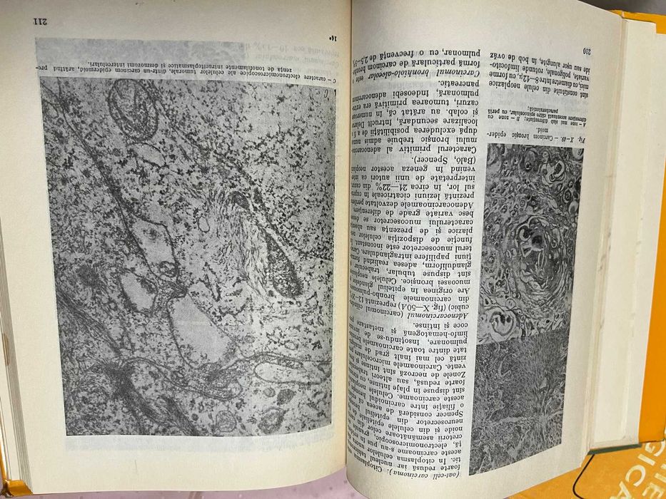 Vand cursuri de Anatomie Patologica , editia 1980