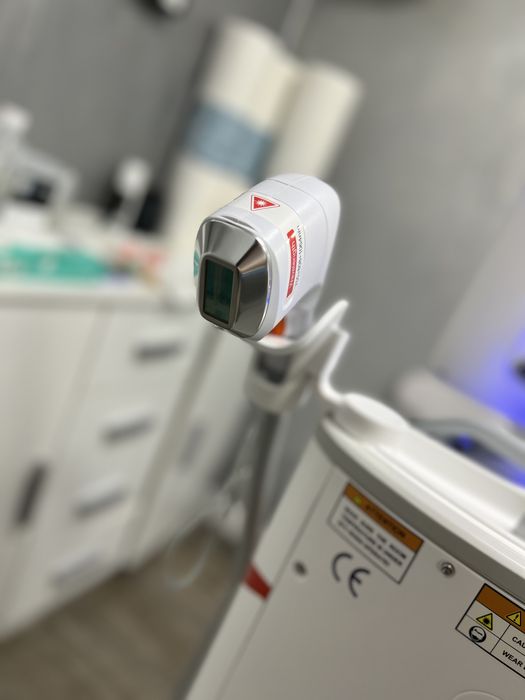 Aparat epilare definitiva