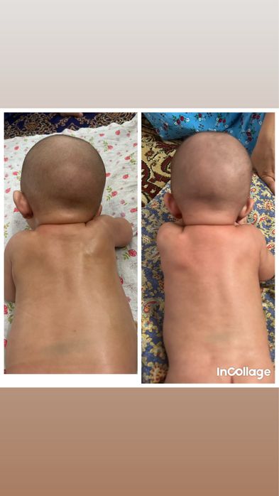 Детский массаж на дому