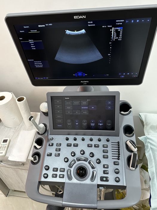 Продаётся УЗИ аппарат