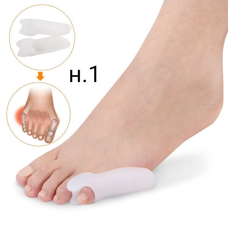 Изпъкнали кокалчета ”hallux valgus”-различни видове