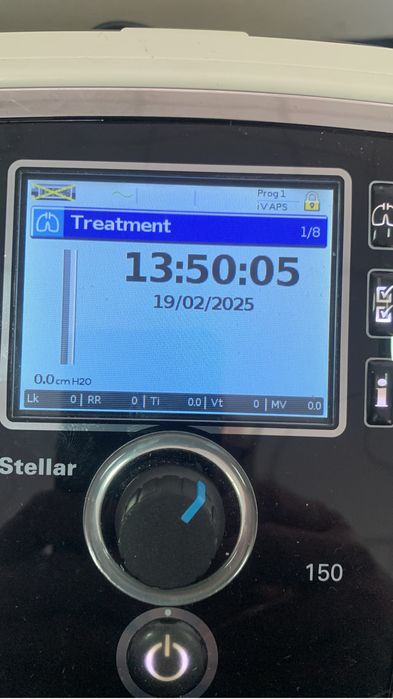 Resmed stellar 150 apnee