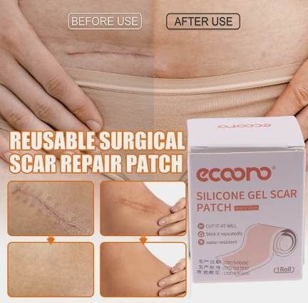 Силиконовый пластырь для лечения шрамов и рубцов. 4 см на 50 см