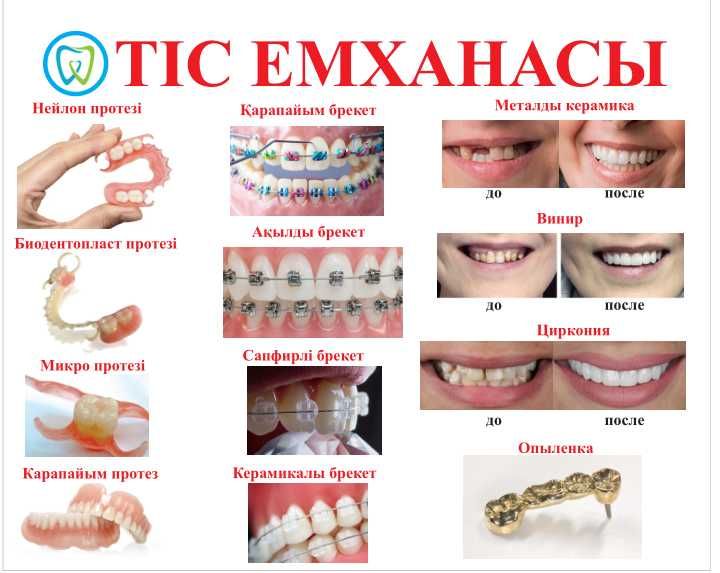 Шымкент қаласы Тіс емханасы Стоматология