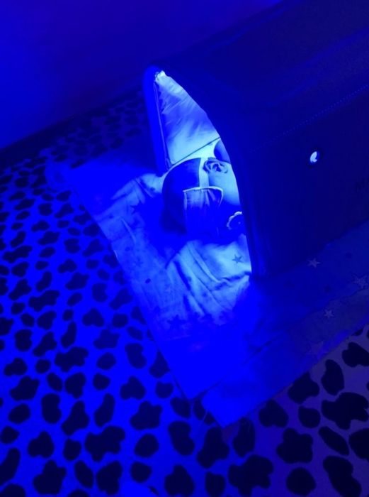 Фотолампа от желтухи, аренда 7дней-5000тг акция!!!