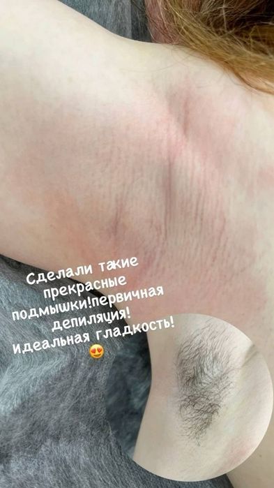Депиляция для женщины