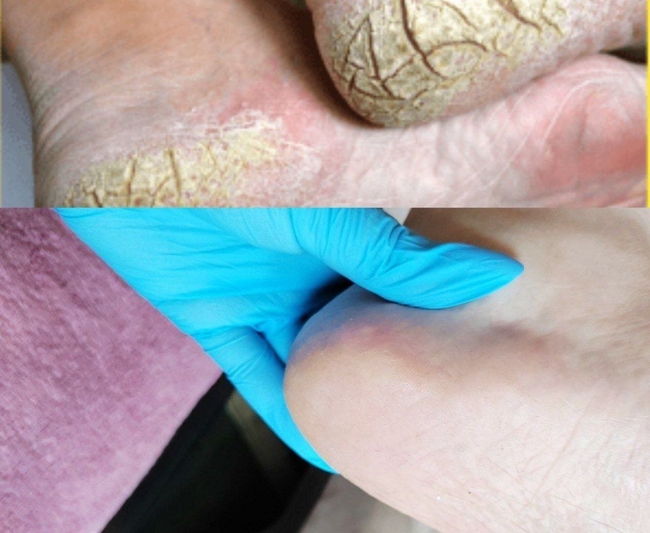 Manikyur pedicure Arzon