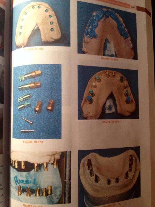 Dental Implant Prosthetics, 2ed (2015)