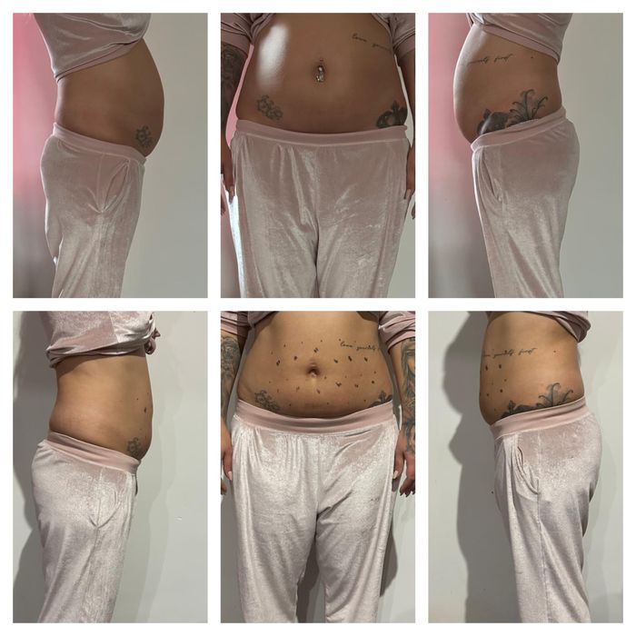 Liposonix oferta luna Ianuarie