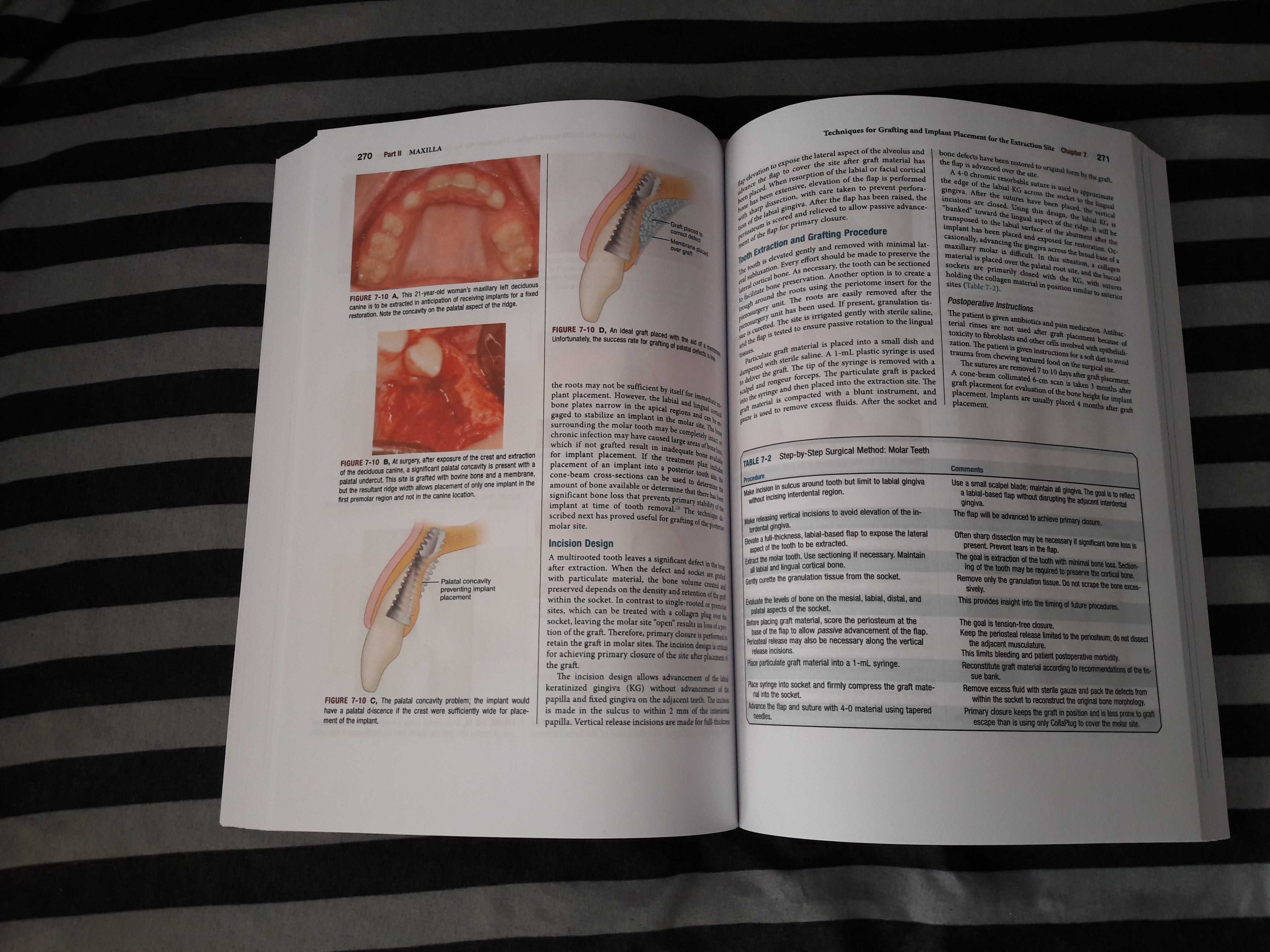 Dental Implant Complications, Stuart J. Froum Edition 2 - 2016