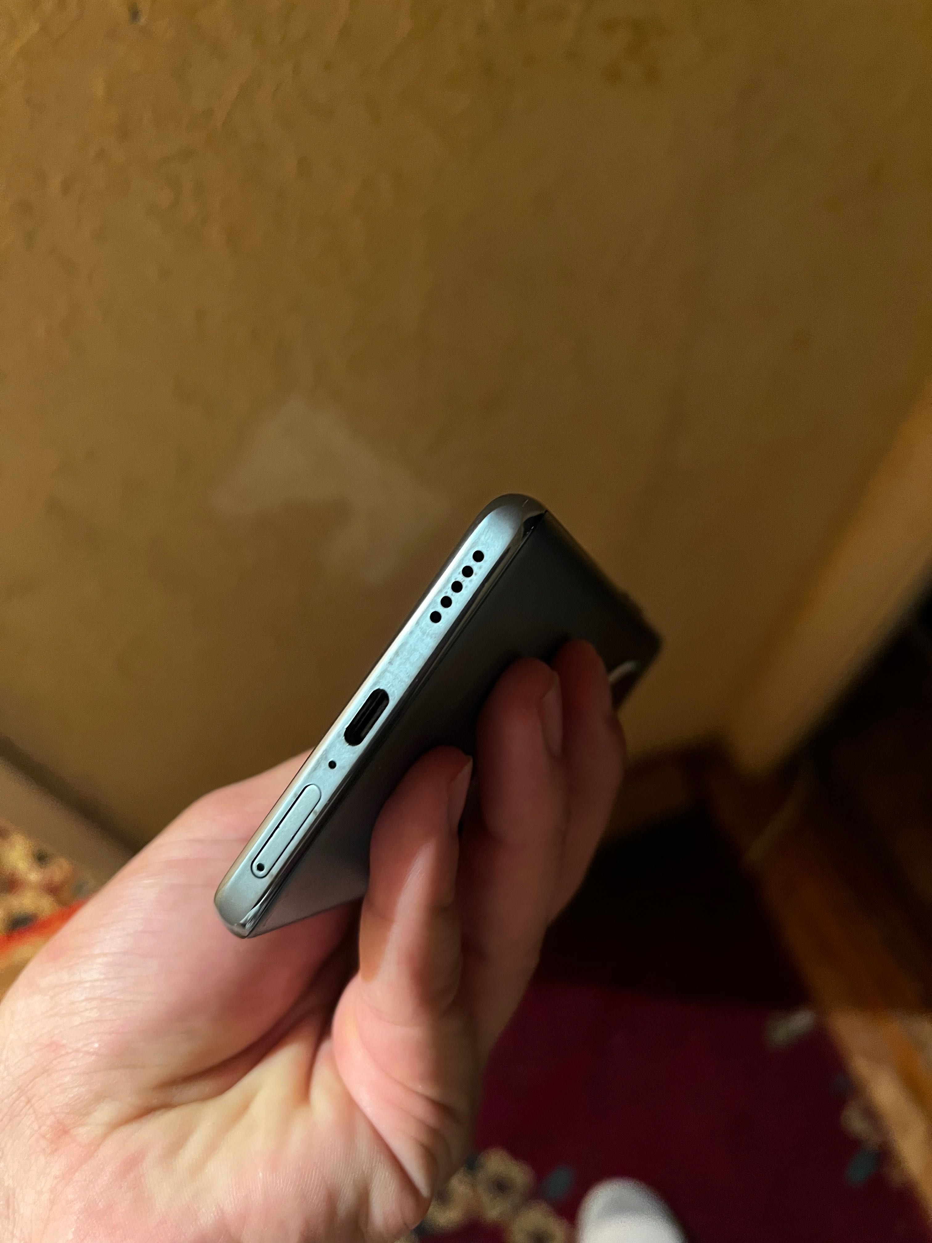 Honor X9b 5g    Telifon qisela hammasini chuntiraman