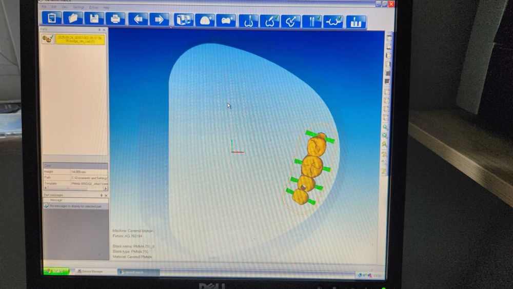 Tehnica dentara CAD CAM Amann Girrbach Motion 1 sistem complet
