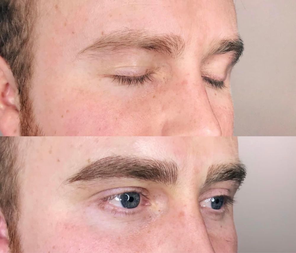 Micropigmentare barba barbati, scalp, sprancene alopecie