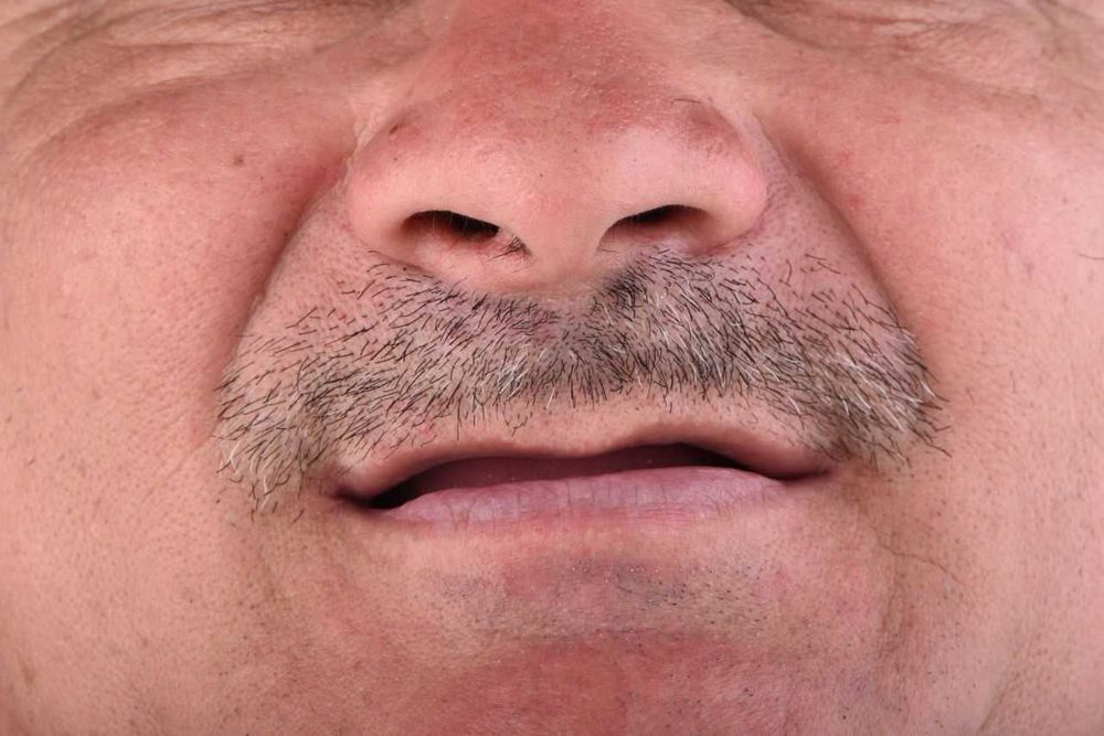 Зуботехническая Технология CAD/CAM в стоматологии