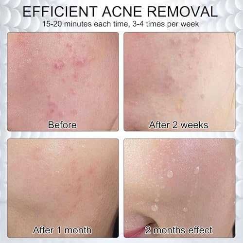 Нова Маска за лице 7 LED цвята домашна грижа за кожа Светлинна терапия