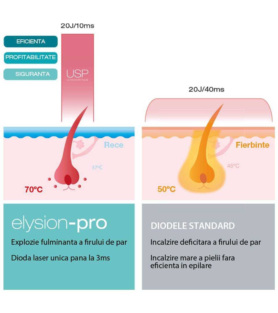 Vand aparat laser dioda de epilare definitiva Elysion Pro