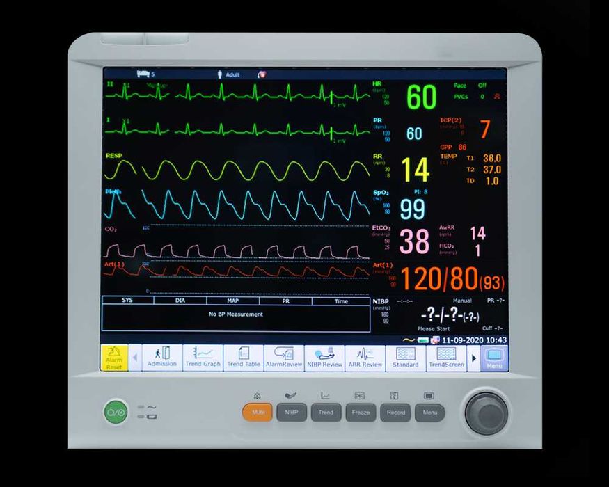 Монитор пациента Edan IM80
