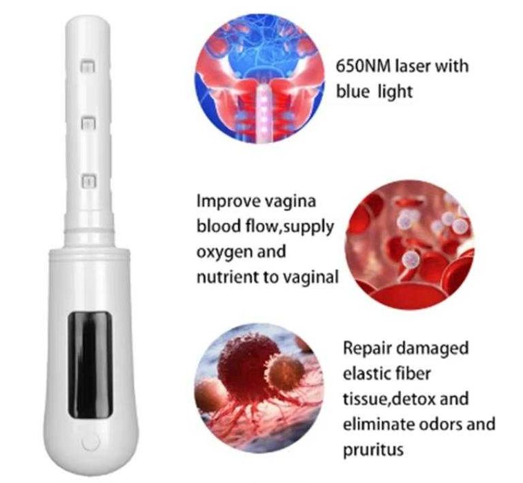 360° Гинекологично Неинвазивна Лазерна Терапия за Влагалищно Затягане