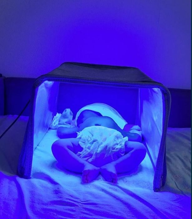 Лампа от желтушки / желтухи от 1000 фотолампа кувез / кювез / фонарь