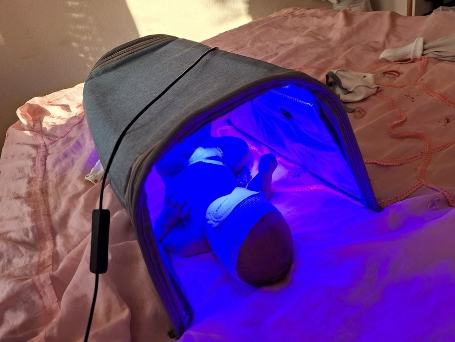 Продам фотолампу от желтушки