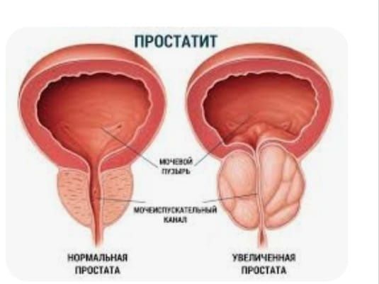 Массаж урологически для мужчин