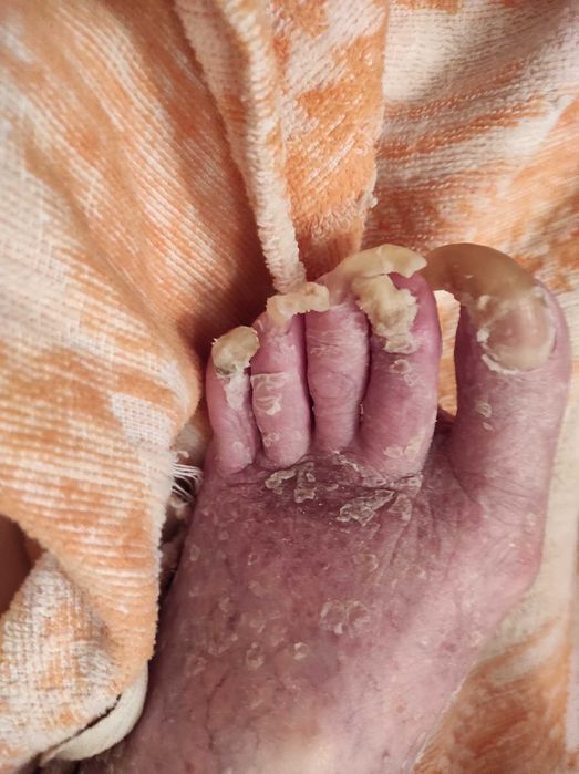 Медицински педикюр по домовете